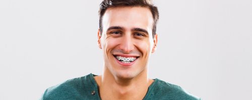 lachender Mann mit moderne, fester Zahnspange
