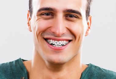 Erwachsener mit fester Zahnspange lächelt