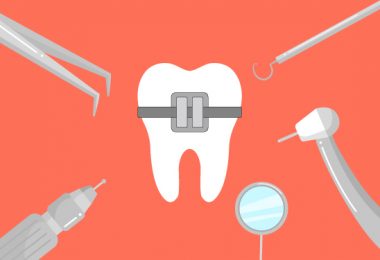 Zahnreinigung Zahnspangen Illustration