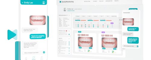 Dental Monitoring 360gradzahnspange